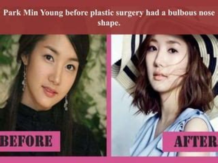 Did Park Min Young Have Plastic Surgery? Park Min Young Before and After