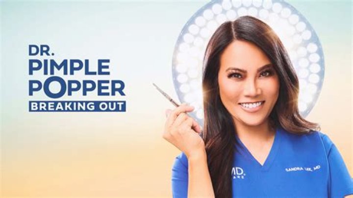 Dr. Pimple Poppers patient passed away months after the show aired Wed 10 May 2023 20:00