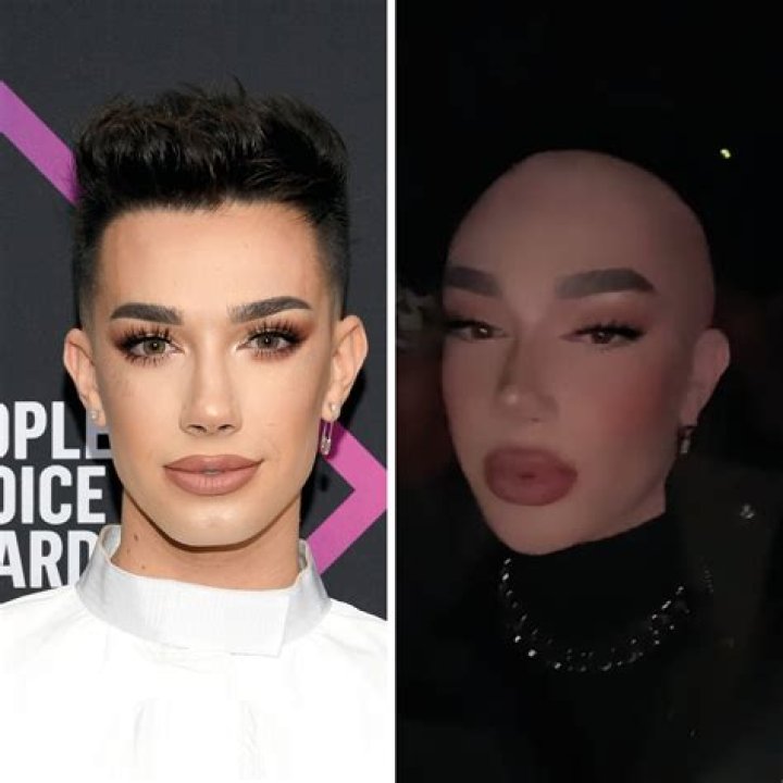 James Charles Bald: The Transformation of a Beauty Icon