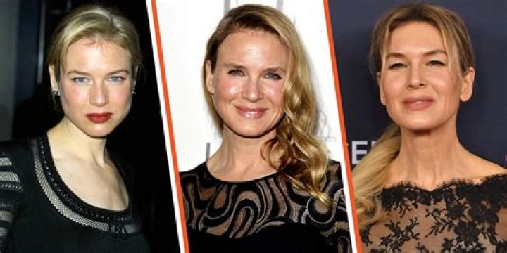 Renée Zellweger Plastic Surgery: The Transformation of an Icon