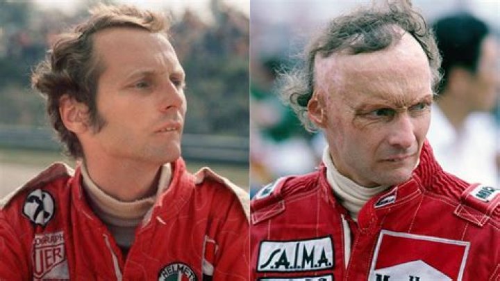Rush: What Happened To Niki Lauda? Death Cause -Everything To Know About The Austrian Formula 1 Driv