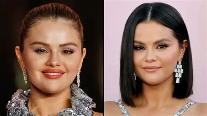 Selena Gomez laughs off cheek filler claims, reveals she's had Botox ·