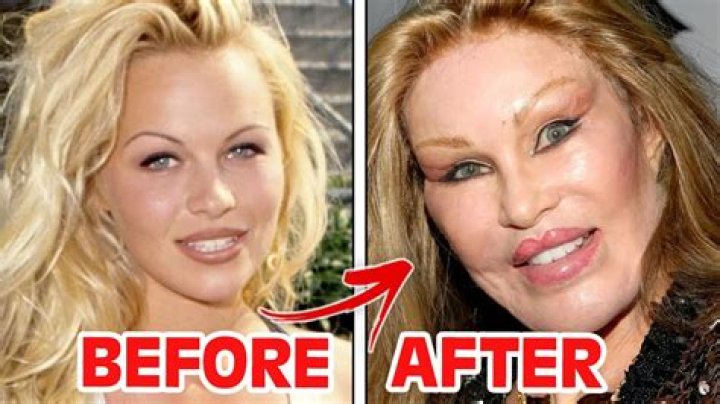 Stell SB19 Plastic Surgery Before And After Photos