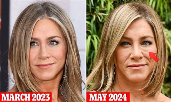 Truth Behind Jennifer Aniston's Face Scar & No-make Up Look ·