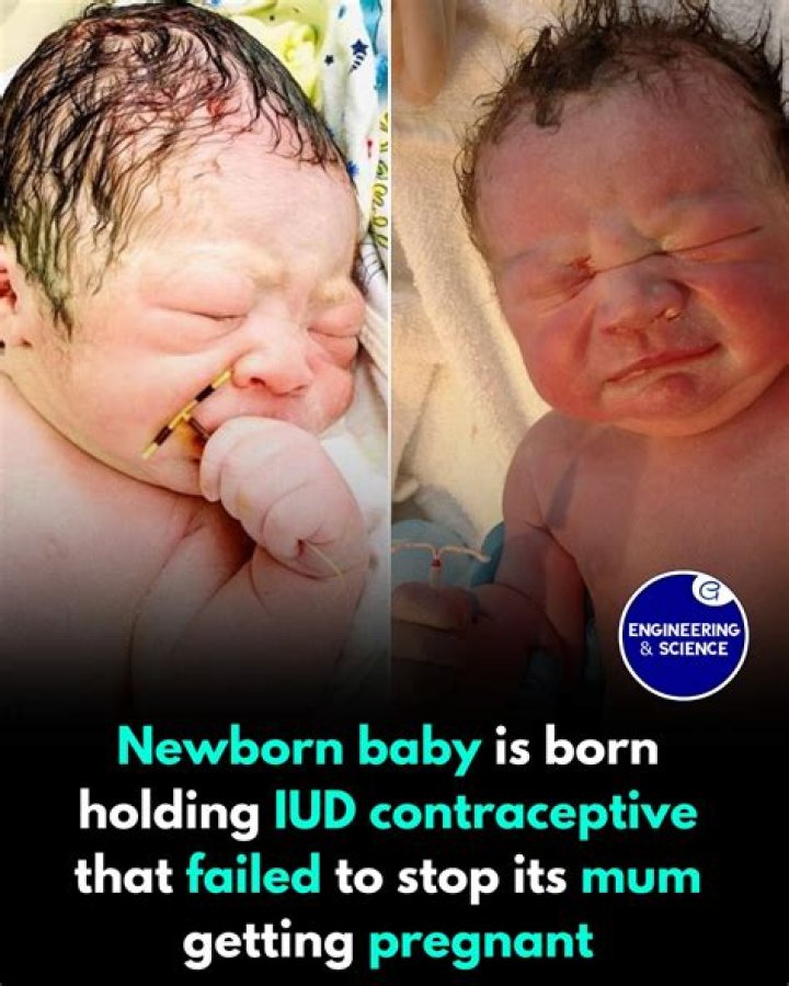 Understanding Baby Holding IUD: A Comprehensive Guide